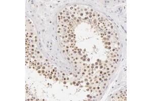 Immunohistochemical staining of human testis with ZNF597 polyclonal antibody  shows moderate nuclear positivity in cells in ductus seminiferus. (ZNF597 antibody)