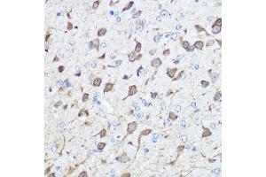 Immunohistochemistry of paraffin-embedded human esophageal using Parvalbumin (Parvalbumin (PVALB)) Rabbit pAb (ABIN6128526, ABIN6146506, ABIN6146507 and ABIN6217573) at dilution of 1:100 (40x lens).