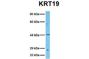 Host:  Rabbit  Target Name:  KRT19  Sample Tissue:  Human Fetal Kidney  Antibody Dilution:  1. (Cytokeratin 19 antibody  (N-Term))