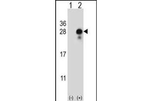 Western blot analysis of DLK2 (arrow) using rabbit polyclonal DLK2 Antibody (C-term) (ABIN652972 and ABIN2842616). (DLK2 antibody  (C-Term))