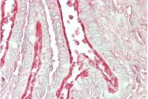 ABIN768580 (5µg/ml) staining of paraffin embedded Human Lung. (ARL6 antibody  (Internal Region))
