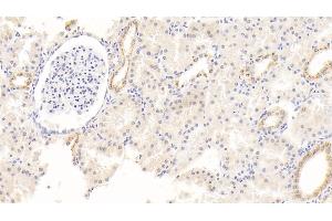 Detection of ALB in Human Kidney Tissue using Monoclonal Antibody to Albumin (ALB) (Albumin antibody)
