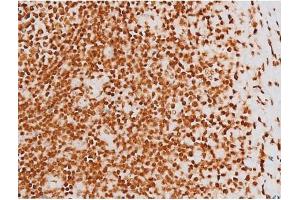 ABIN6267604 at 1/200 staining Human tonsil tissue sections by IHC-P. (c-Rel antibody  (pSer503))