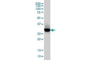 CAPZB monoclonal antibody (M03), clone 4H8 Western Blot analysis of CAPZB expression in HeLa . (CAPZB antibody  (AA 192-272))