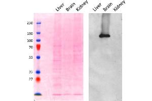 Western Blotting (WB) image for anti-Adaptor-Related Protein Complex 2, alpha 1 Subunit (AP2A1) (AA 706-727) antibody (ABIN5539681)