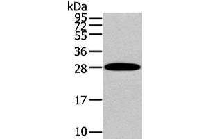Western Blot analysis of Human liver cancer tissue using ZNF365 Polyclonal Antibody at dilution of 1/200 (ZNF365 antibody)