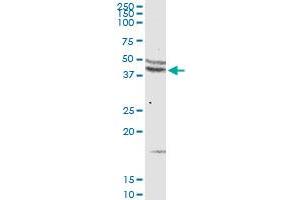 CCR5 MaxPab rabbit polyclonal antibody. (CCR5 antibody  (AA 1-352))