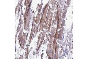 Immunohistochemical staining (Formalin-fixed paraffin-embedded sections) of human heart muscle with CD1E polyclonal antibody  shows moderate to strong cytoplasmic positivity in myocytes. (CD1e antibody  (AA 79-147))