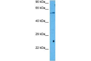 Host:  Mouse  Target Name:  RORA  Sample Tissue:  Mouse Liver  Antibody Dilution:  1ug/ml (RORA antibody  (Middle Region))