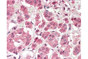 Human, Adrenal: Formalin-Fixed Paraffin-Embedded (FFPE). (PBX2 antibody  (N-Term))
