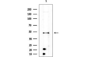 anti-Kallikrein 2 (KLK2) (Internal Region) antibody