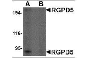 Western blot analysis of RGPD5 in human thymus tissue lysate with this product at 1 μg/ml in (A) the absence and (B) the presense of blocking peptide.