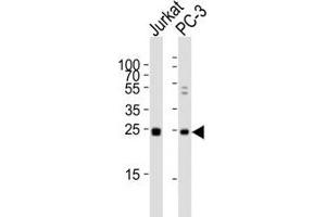 Western blot analysis of lysate from human Jurkat and rat PC-3 lysate using HMGB4 antibody diluted at 1:1000. (HMGB4 antibody  (AA 45-73))