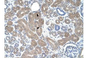 ST3GAL5 antibody was used for immunohistochemistry at a concentration of 4-8 ug/ml to stain Epithelial cells of renal tubule (arrows) in Human Kidney. (ST3GAL5 antibody  (N-Term))