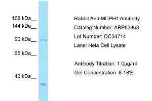 Western Blotting (WB) image for anti-Microcephalin 1 (MCPH1) (C-Term) antibody (ABIN2789647) (MCPH1 antibody  (C-Term))