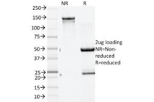 SDS-PAGE Analysis Purified GAD2 (GAD65) Mouse Monoclonal Antibody (GAD2/1960). (GAD65 antibody  (AA 6-99))