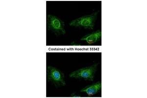 ICC/IF Image Immunofluorescence analysis of methanol-fixed HeLa, using Asporin, antibody at 1:200 dilution. (Asporin antibody)