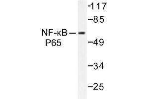 Image no. 1 for anti-Nuclear Factor-kB p65 (NFkBP65) antibody (ABIN271750)