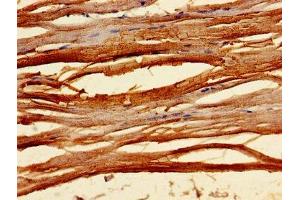 Immunohistochemistry of paraffin-embedded human skeletal muscle tissue using ABIN7173569 at dilution of 1:100