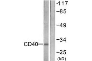 Western blot analysis of extracts from COS7 cells, using CD40 Antibody.