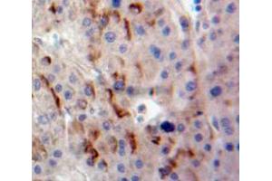 Immunohistochemistry (Paraffin-embedded Sections) (IHC (p)) image for anti-delta-Like 1 Homolog (Drosophila) (DLK1) (AA 24-175) antibody (ABIN2925924)