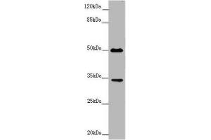 Western blot All lanes: FCGR2B antibody at 2 μg/mL + Mouse liver tissue Secondary Goat polyclonal to rabbit IgG at 1/10000 dilution Predicted band size: 35, 32, 34 kDa Observed band size: 35, 50 kDa (FCGR2B antibody  (AA 12-289))