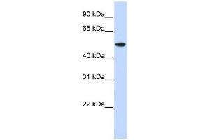 RASGEF1A antibody used at 1 ug/ml to detect target protein. (RASGEF1A antibody  (N-Term))