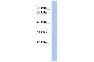 WB Suggested Anti-ZYX Antibody Titration:  0. (ZYX antibody  (Middle Region))