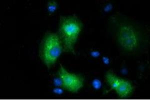 Anti-MGRN1 mouse monoclonal antibody (ABIN2454424) immunofluorescent staining of COS7 cells transiently transfected by pCMV6-ENTRY MGRN1 (RC208284). (Mahogunin RING Finger Protein 1 antibody)