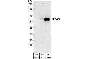 Western Blotting (WB) image for anti-CD5 (CD5) (AA 445-495) antibody (ABIN7450095)