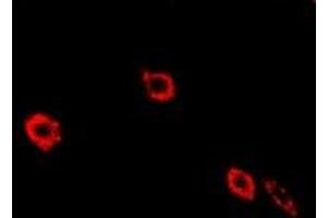 Immunofluorescent analysis of NEK3 staining in Hela cells. (NEK3 antibody)