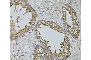 Immunohistochemistry of paraffin-embedded Human prostate using KTN1 Polyclonal Antibody at dilution of 1:100 (40x lens). (KTN1 antibody)