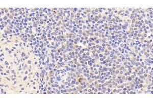 Detection of IL8Rb in Human Spleen Tissue using Polyclonal Antibody to Interleukin 8 Receptor Beta (IL8Rb) (CXCR2 antibody  (AA 1-57))