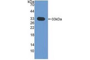 Detection of Recombinant CDK4, Human using Polyclonal Antibody to Cyclin Dependent Kinase 4 (CDK4) (CDK4 antibody  (AA 6-295))