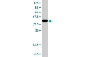 Western Blotting (WB) image for anti-Cytochrome P450, Family 51, Subfamily A, Polypeptide 1 (CYP51A1) (AA 410-509) antibody (ABIN560552)