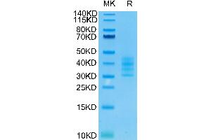 Human BCMA Trimer on Tris-Bis PAGE under reduced condition. (BCMA Protein (Trimer) (His-Avi Tag))