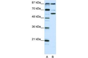Western Blotting (WB) image for anti-K(lysine) Acetyltransferase 2B (KAT2B) antibody (ABIN2460477)