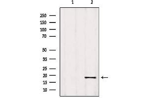 RPP25L antibody  (C-Term)