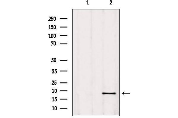 RPP25L antibody  (C-Term)