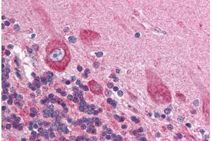 Human Brain, Cerebellum (formalin-fixed, paraffin-embedded) stained with HIF1AN antibody ABIN214112 at 5 ug/ml followed by biotinylated goat anti-rabbit IgG secondary antibody ABIN481713, alkaline phosphatase-streptavidin and chromogen. (HIF1AN antibody  (N-Term))