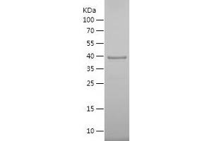 Western Blotting (WB) image for Myocyte Enhancer Factor 2D (MEF2D) (AA 363-521) protein (His-IF2DI Tag) (ABIN7282448) (MEF2D Protein (AA 363-521) (His-IF2DI Tag))