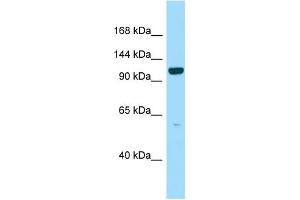 WB Suggested Anti-PPFIBP2 Antibody Titration: 1. (PPFIBP2 antibody  (C-Term))