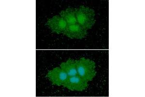 ICC/IF analysis of ASS1 in Hep3B cells line, stained with DAPI (Blue) for nucleus staining and monoclonal anti-human ASS1 antibody (1:100) with goat anti-mouse IgG-Alexa fluor 488 conjugate (Green). (ASS1 antibody  (AA 1-412))