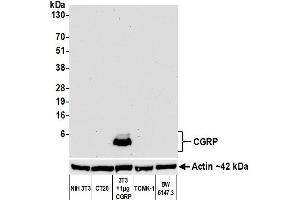 Western Blotting (WB) image for anti-Calcitonin-Related Polypeptide alpha (CALCA) antibody (ABIN7449372) (Recombinant CGRP antibody)
