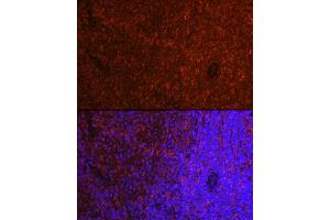 Immunofluorescence analysis of rat spleen cells using ASC/TMS1 Rabbit pAb (ABIN3021616, ABIN3021617, ABIN3021618, ABIN1513454 and ABIN6215392) at dilution of 1:250 (40x lens). (PYCARD antibody  (AA 50-195))