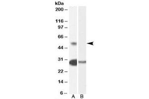 Western blot testing of human testis lysate with TCFL5 antibody at 0. (TCFL5 antibody)