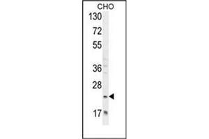 Western blot analysis of RILPL2 Antibody (Center) in CHO cell line lysates (35ug/lane). (RILPL2 antibody  (Middle Region))