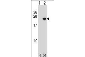 Western blot analysis of Park4 (arrow) using rabbit polyclonal Park4 Antibody (C-term) (ABIN390368 and ABIN2840773). (SNCA antibody  (C-Term))