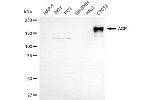 Western blotting analysis using ACE antibody (ABIN7797605).