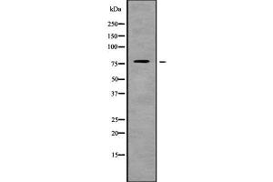 Western blot analysis of ARHGEF4 using LOVO whole cell lysates (ARHGEF4 antibody  (Internal Region))